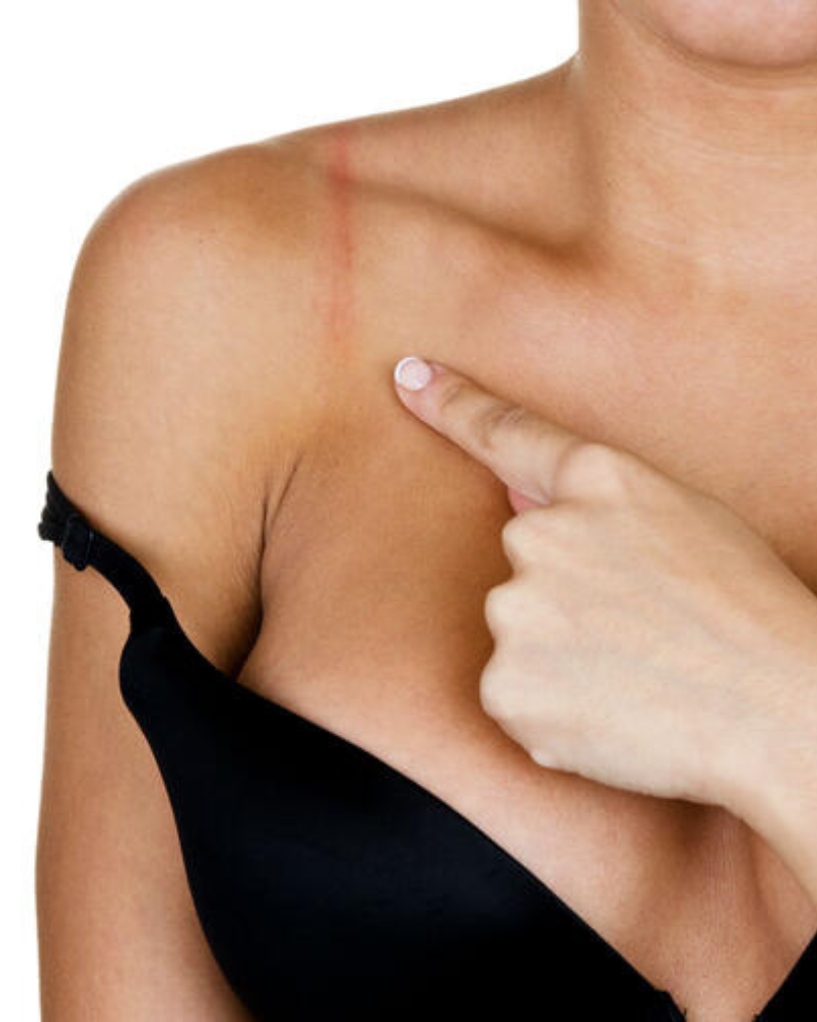 Breteles clavados en el hombro